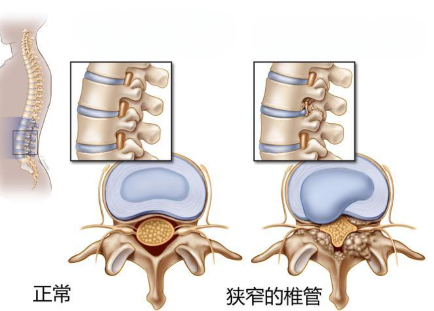 邵陽創(chuàng)傷骨科,邵陽風(fēng)濕病區(qū),邵陽骨質(zhì)增生,邵陽關(guān)節(jié)病區(qū),邵陽頸椎病區(qū)